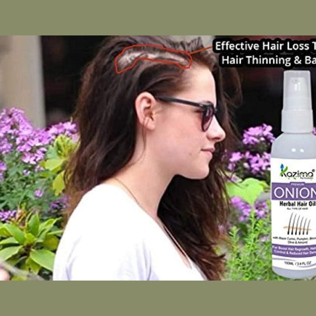 KAZIMA Premium Quality Onion Herbal Hair Oil For Unisex - ALL TYPE OF HAIR - Boost Hair Regrowth, Anti Hair Fall Control & Removes Dandruff - 100ml