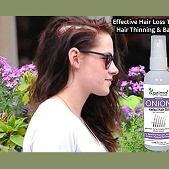 Kazima Onion Herbal Hair Oil For Unisex - All Type Of Hair - Boost Hair Regrowth, Anti Hair Fall Control & Removes Dandruff (100 Ml)