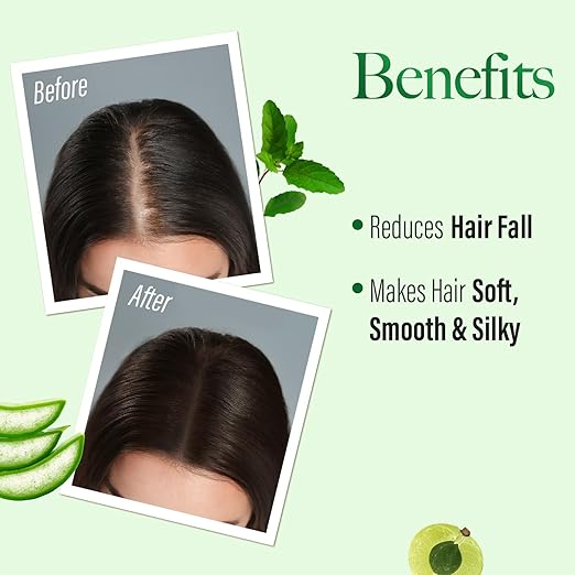 KESH KING Anti-Hairfall Shampoo 340 ml