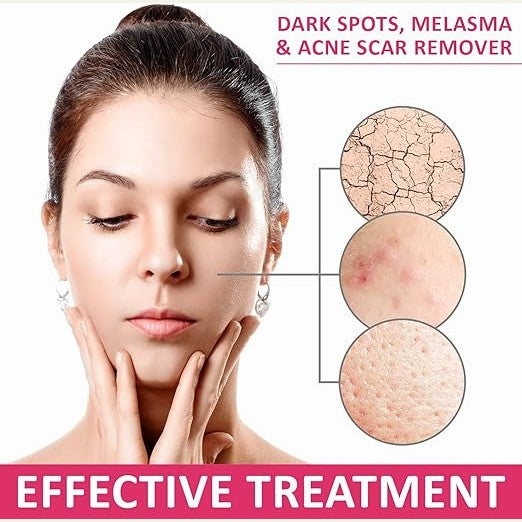 Gluta Frozen Supreme White thione Skin Whitening Softgel Capsules Skin Moisturizer Collagen Stimulator Healthy Blood Circulation Remove Dark Spots & Acne Scars L- thione 1500000mg (Pack of 6)