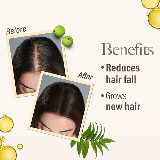 KESH KING Ayurvedic Scalp And Hair Oil, 100 ml