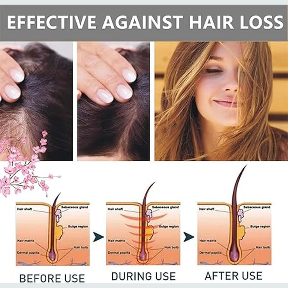 Boundbreed Sakura Japanese Shampoo,Sakura Japanese Shampoo for Hair Loss,Sakura Hair Growth Japan's No. 1 Shampoo,Sakura Japanese Shampoo and Conditioner,300ml Create Thick, Shiny Hair (Shampoo)