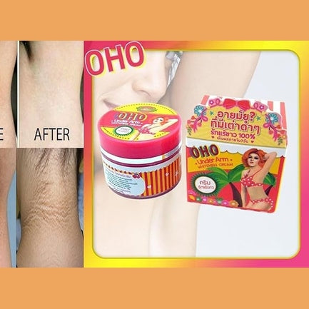 OHO SOFT CREAM Within In 7 Days GLUTA WHITE COLLAGEN REDUCE SCAR DARK SPOTS KNEE ELBOW 10G.