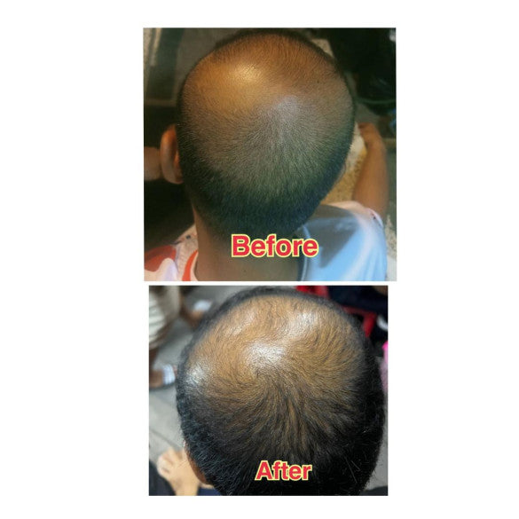 Caris Gold Hair Growth Lotion 100ml Hair Nutrition and Treatment.